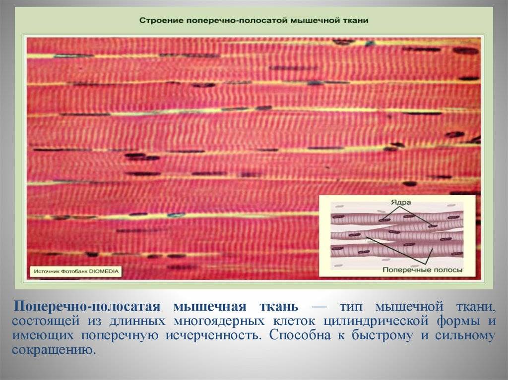 В поперечнополосатой мышечной ткани клетки какие. Поперечная исчерченность в поперечно полосатой ткани. Волокна поперечно-полосатой мышечной ткани многоядерные. Поперечная исчерченность скелетной мышечной ткани. Скелетная поперечно-полосатая мышечная ткань сокращается.